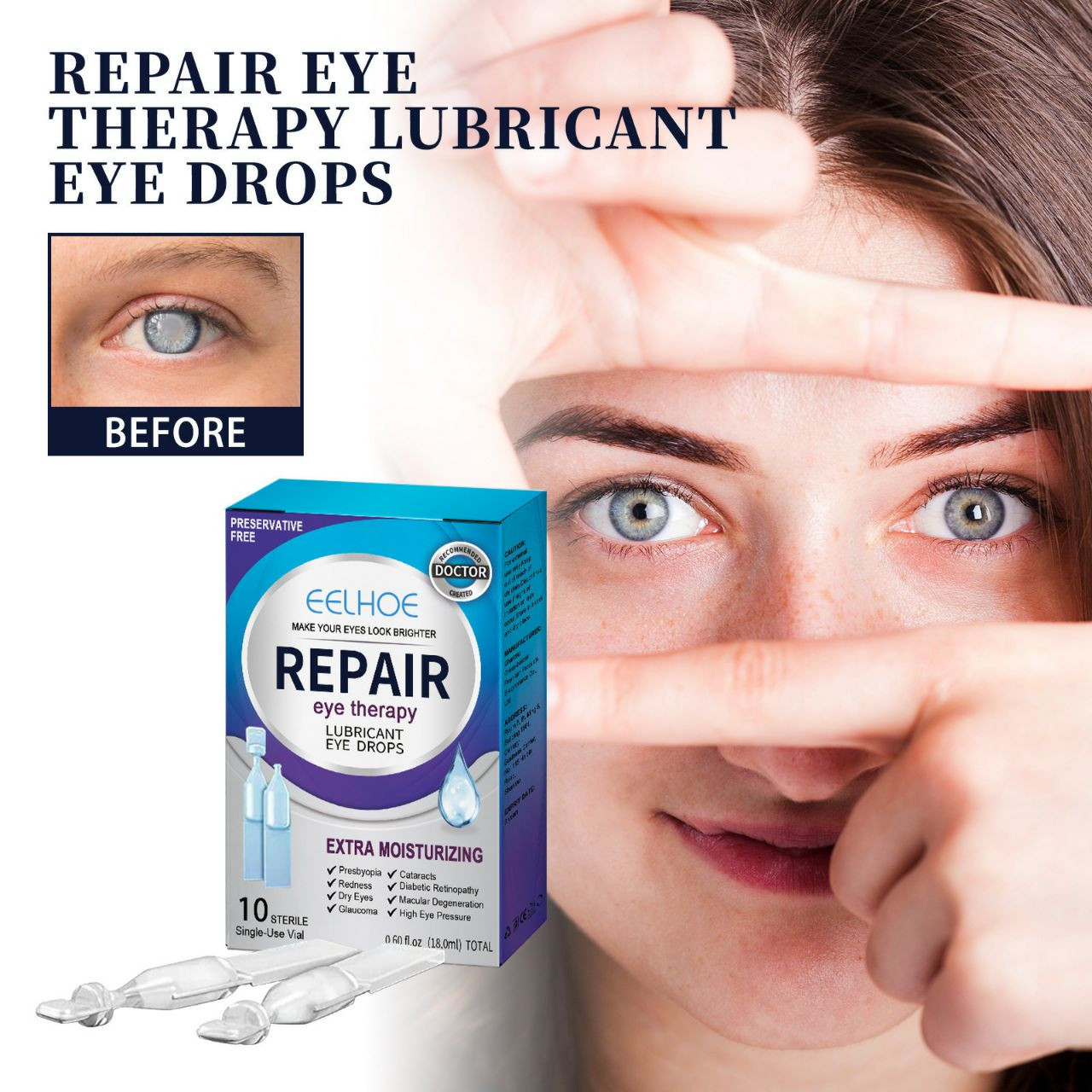 Les gouttes pour les yeux d'Eelhoe soulagent les yeux secs, les rougeurs, les yeux flous, la fatigue de la vue, la vision floue et la solution hydratante des soins oculaires 18ml